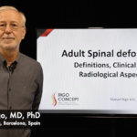 Adult Spinal Deformity: Definitions, Clinical and Radiological Aspects