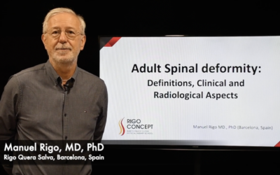 Adult Spinal Deformity: Definitions, Clinical and Radiological Aspects